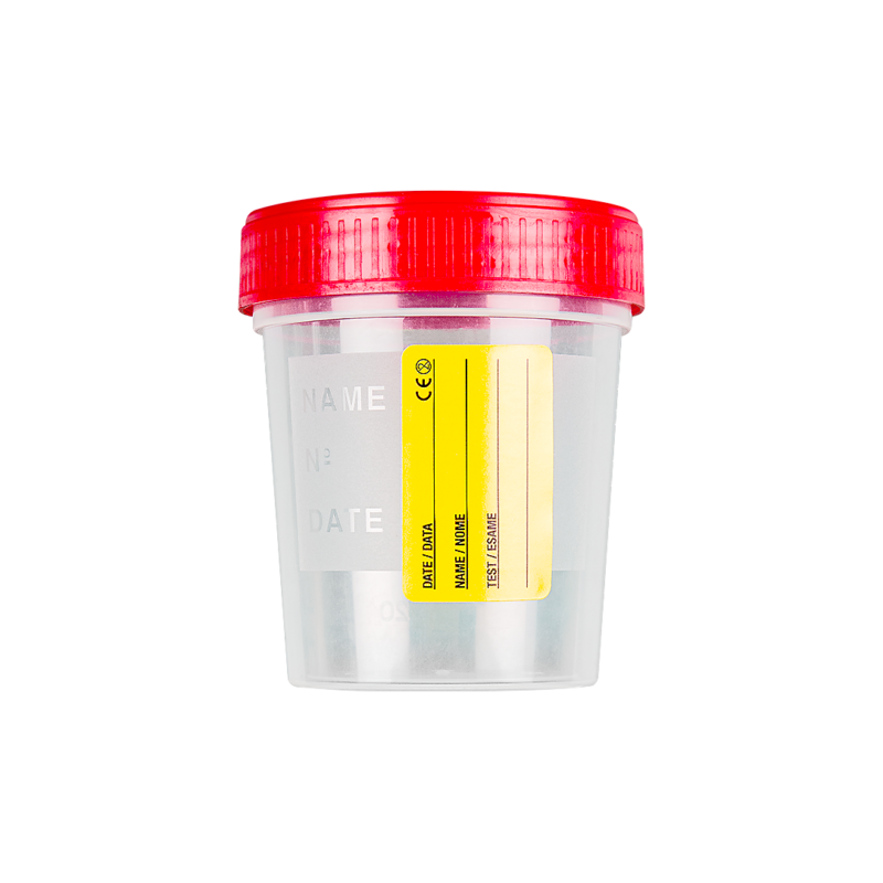 contenitore per urina con etichetta cartacea con tappo a vite