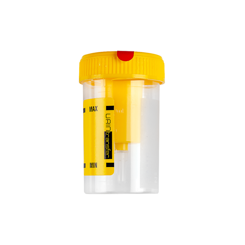 contenitore per urina con etichetta cartacea e sistema di aspirazione per provette sottovuoto