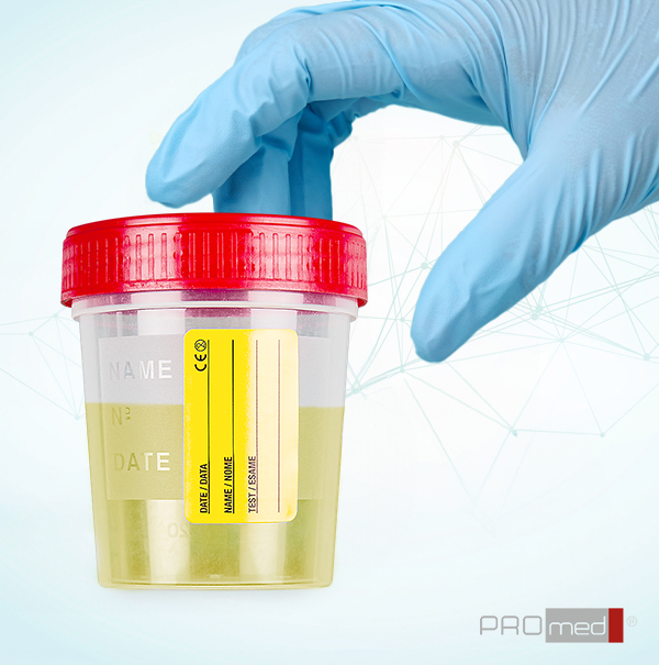 urintainer® 120 ml containers: reliability, safety and suitability